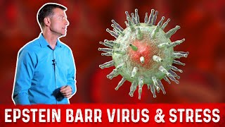 What is Epstein Barr Virus EBV  Symptoms amp Treatment – Dr Berg [upl. by Eudocia]