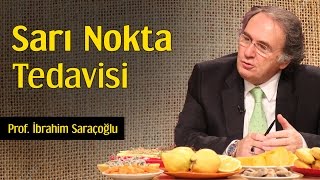 Sarı Nokta Tedavisi  Prof İbrahim Saraçoğlu [upl. by Rayford]