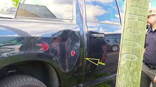 INSANE DENT PULL  Awesome Trick  Gnarly Bedside Dent [upl. by Salkcin828]