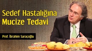 Sedef Hastalığına Mucize Tedavi  Prof İbrahim Saraçoğlu [upl. by Erialb328]