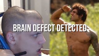 BRAIN DEFECT DETECTED [upl. by Talia]