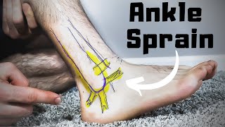 Twisted or Rolled Ankle Sprain Treatment FASTER Home Recovery Time [upl. by Drofwarc]